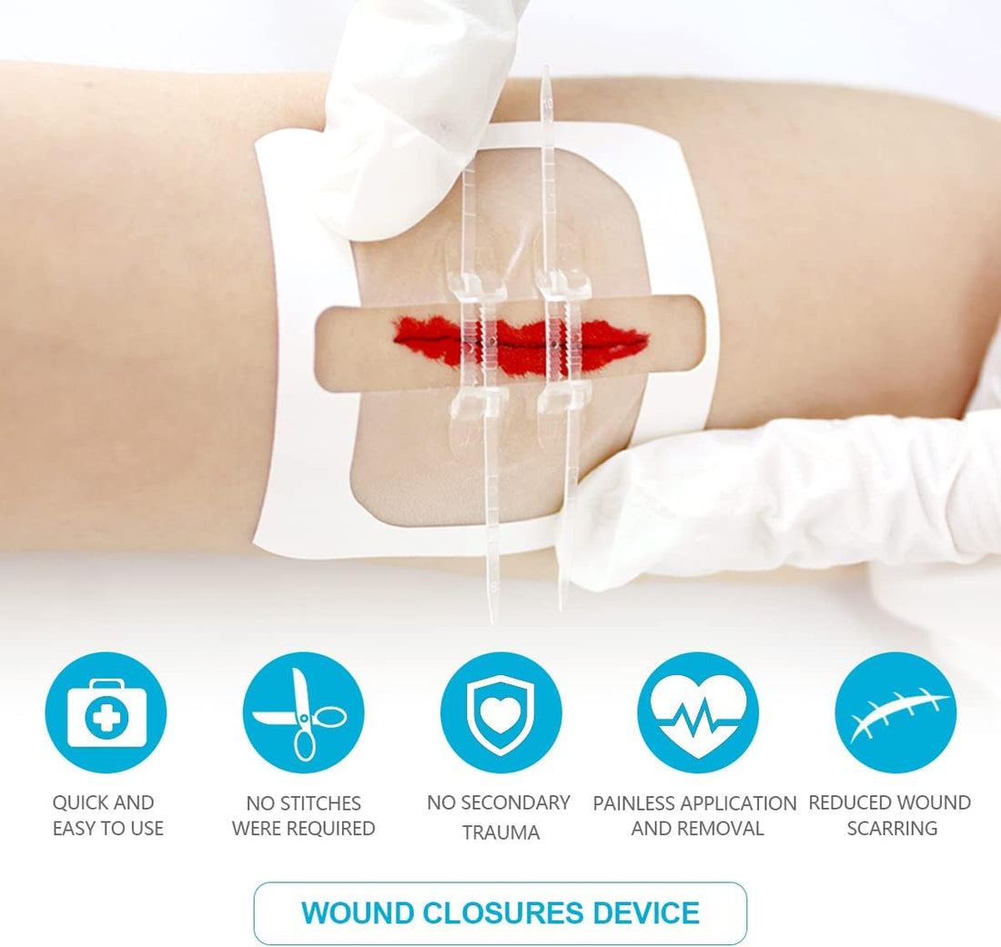 Senvok Wound Clousure Device